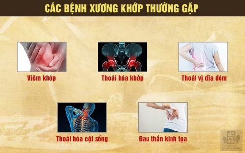 Benh Xuong Khop Thuong Gap